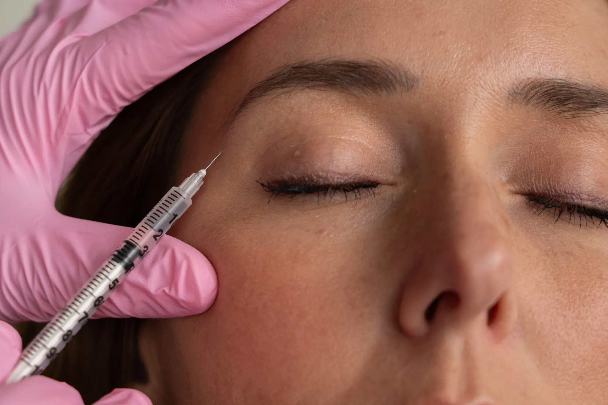 Botox injection treatment at IRIS Aesthetics in Longmont, CO